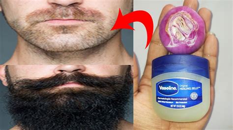 Does Vaseline help mustache grow?