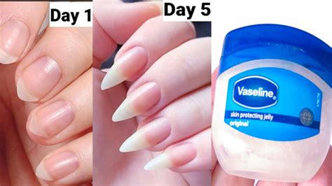Does Vaseline help with nail growth?