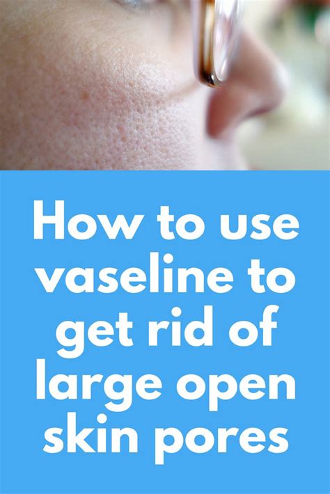 Does Vaseline increase pore size?