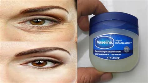 Does Vaseline remove eye bags?