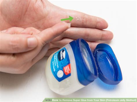 Does Vaseline remove super glue from skin?