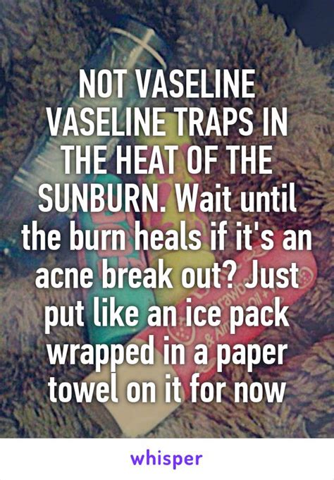 Does Vaseline trap heat?