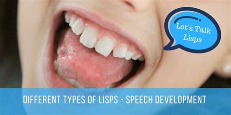 Does a big tongue cause a lisp?