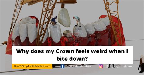 Does a crown feel weird?