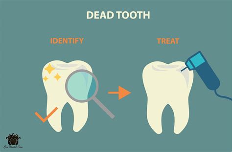Does a dead tooth hurt?