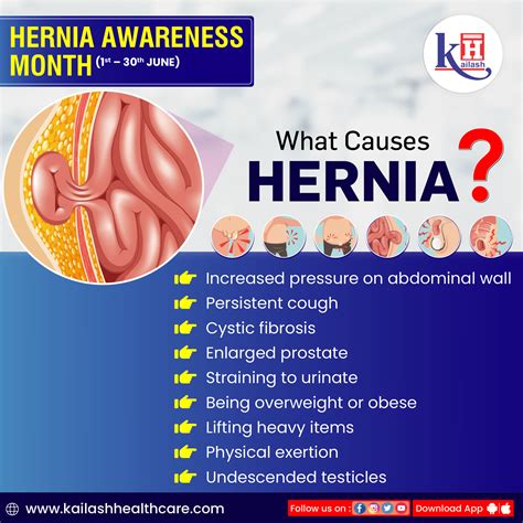 Does a hernia hurt if you push on it?