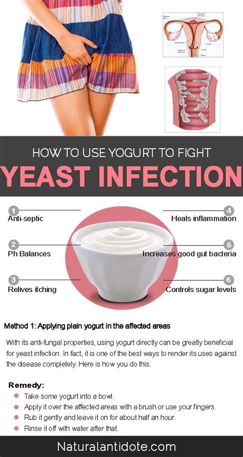 Does a yeast infection itch more before it gets better?