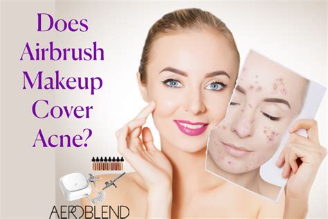 Does airbrush cover acne?