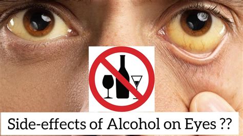 Does alcohol damage glass?