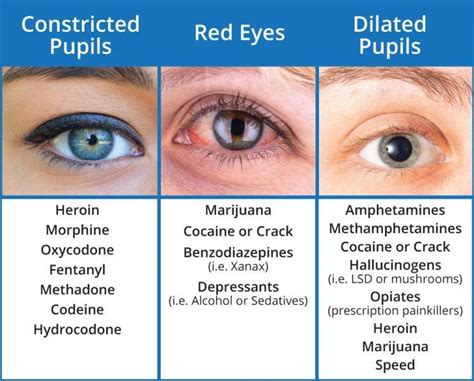 Does alcohol dilate pupils?