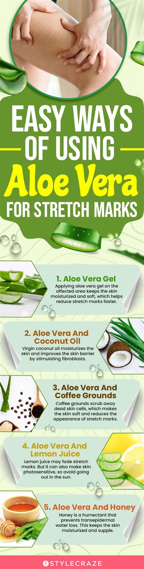 Does aloe vera clear stretch marks?