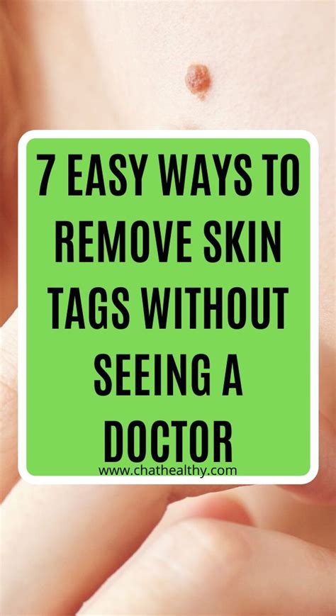 Does anything dissolve skin tags?