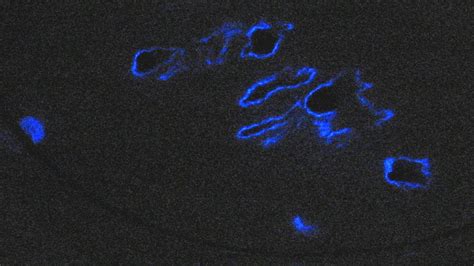 Does anything hide blood from luminol?