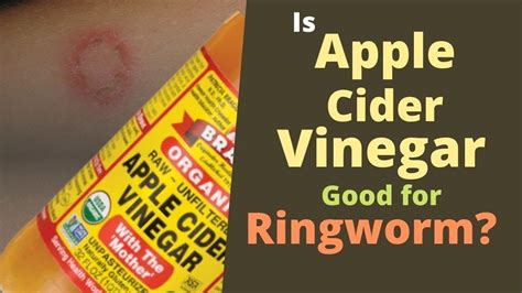 Does apple cider vinegar kill snails?