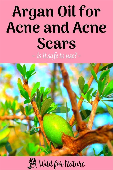 Does argan oil cause acne?