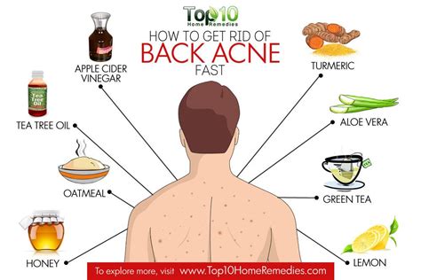 Does back acne go away?