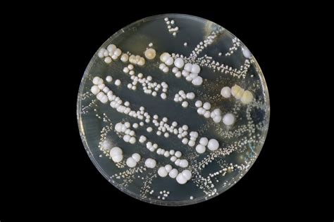 Does bacteria grow on wax?