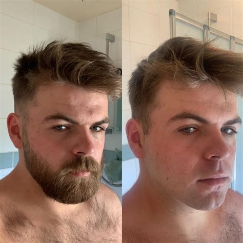 Does beard grow after 18?