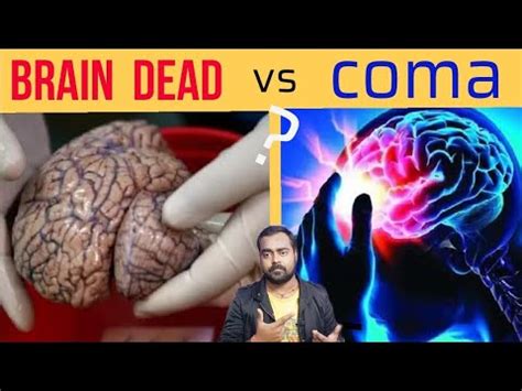 Does brain death mean dead?