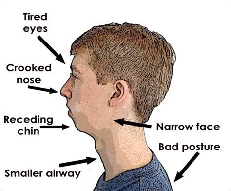 Does breathing change your facial structure?