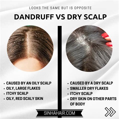 Does brushing help dry scalp?