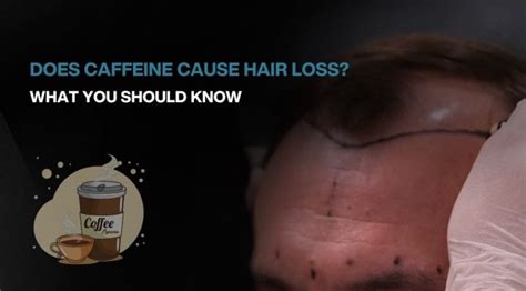 Does caffeine cause hair loss?