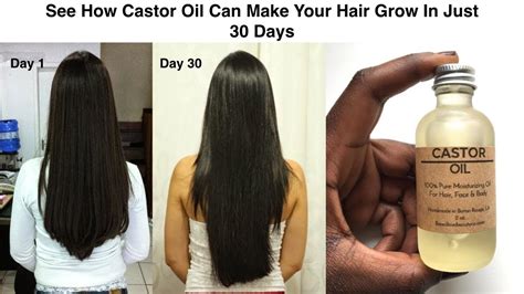 Does castor oil grow hair?