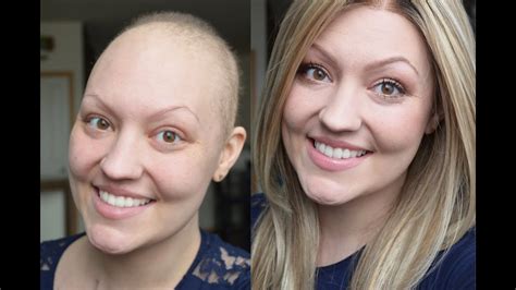 Does chemo change your face?