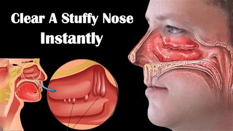 Does closing your nose remove taste?