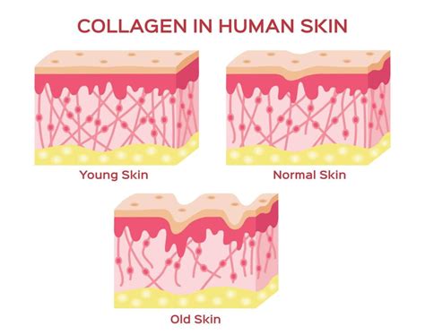 Does cold stimulate collagen?