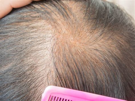 Does damaged hair age you?