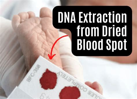 Does dried blood have DNA?