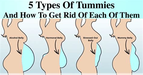 Does everyone have a little tummy?