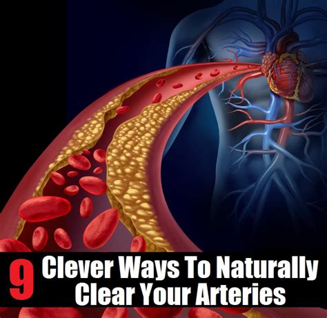 Does exercise widen arteries?