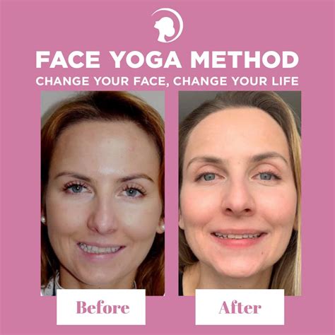 Does face yoga really work for wrinkles?