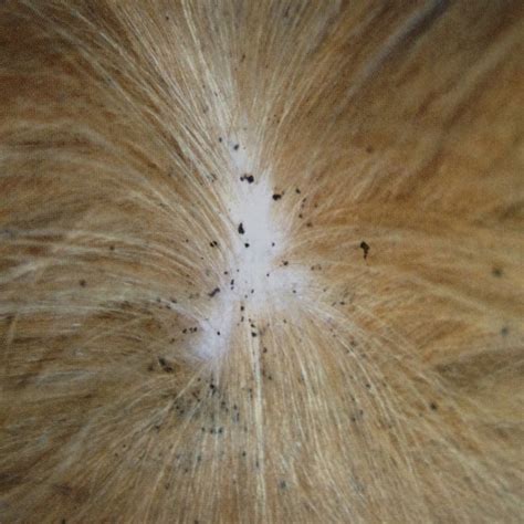 Does flea dirt mean fleas?
