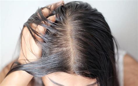 Does greasy hair make your scalp more visible?