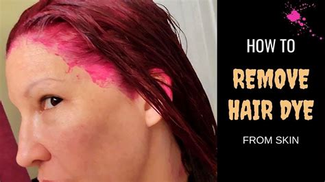 Does hair dye come off skin easily?