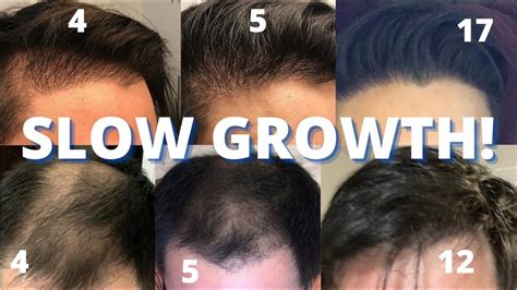 Does hair grow slower after haircut?