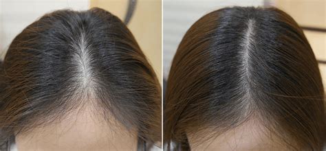 Does hair look thin after oiling?