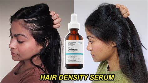 Does hair serum help with frizzy hair?