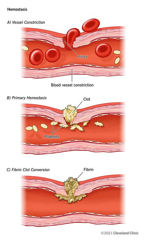 Does hemostatic stop bleeding?