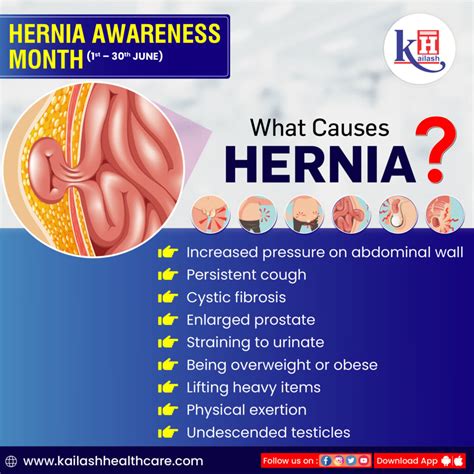 Does hernia make you pee a lot?