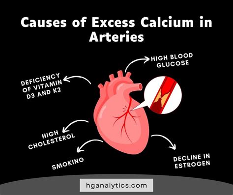 Does high calcium mean clogged arteries?