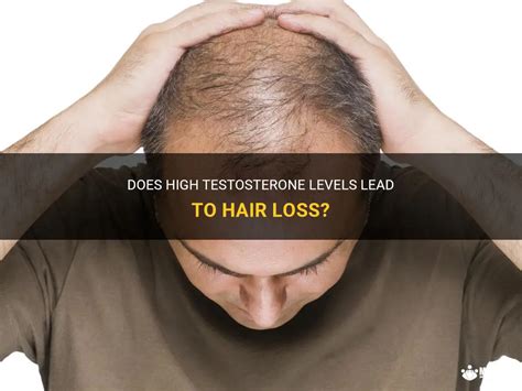 Does high testosterone cause oily hair?