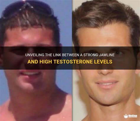 Does higher testosterone mean better jawline?