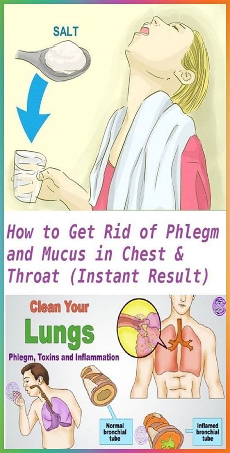 Does hitting your chest break up mucus?