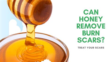 Does honey remove burn scars?