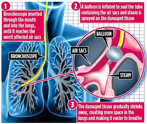 Does hot water clear your lungs?