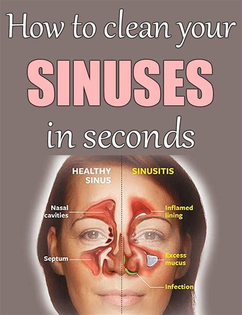 Does hot water unclog sinuses?